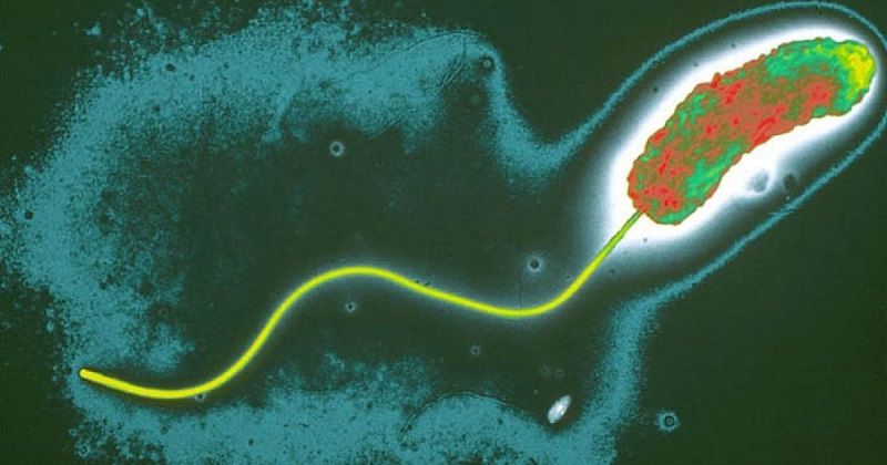 Các phương pháp điều trị nhiễm khuẩn Vibrio không phải bệnh tả là gì?