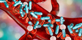 Các triệu chứng của nhiễm trùng huyết do Streptococcus pneumoniae là gì?