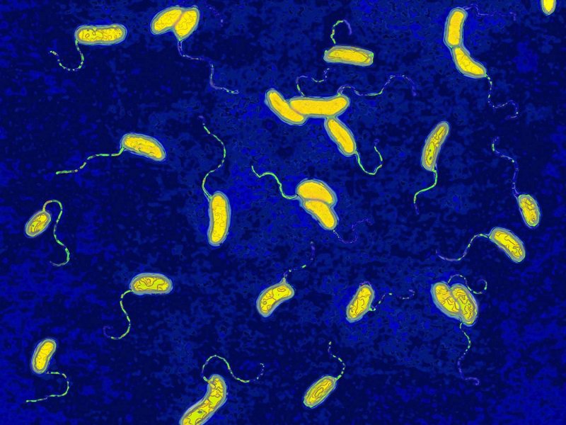 nhiễm khuẩn Vibrio không phải tả
