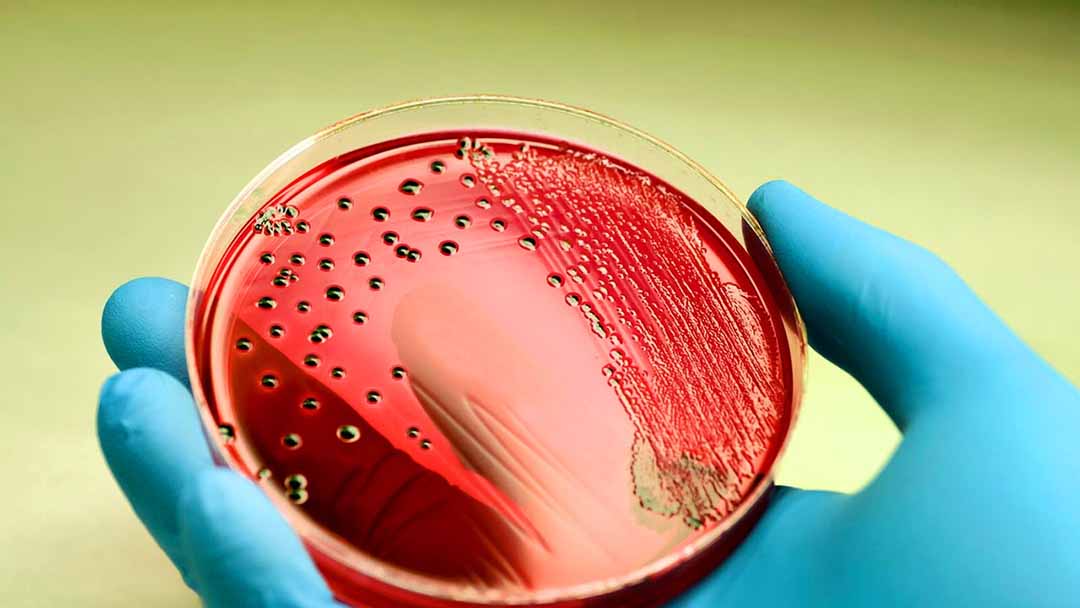 Nhiễm trùng huyết do streptococcus pneumoniae có thể gây ra những bệnh gì?