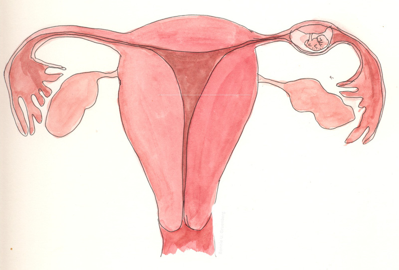 Những hạng mục kiểm tra thai ngoài tử cung là gì?