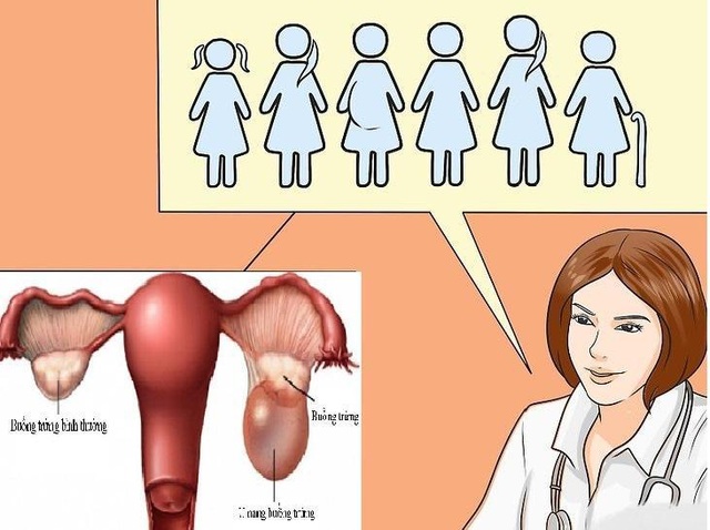 Bệnh u nang lympho ở cổ tử cung có thể gây ra những bệnh gì?