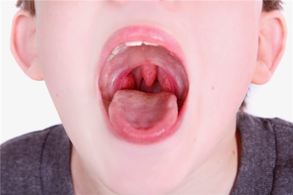 Bệnh ung thư vòm họng mềm có thể gây ra những bệnh gì?