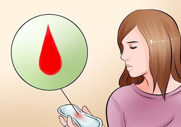 Các hạng mục kiểm tra bệnh u máu âm hộ là gì?