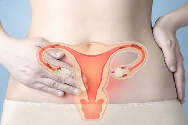 Các phương pháp điều trị ung thư cổ tử cung khi mang thai là gì?