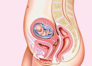 Co thắt tử cung là gì? Nguyên nhân và cách điều trị