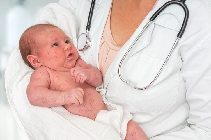 Làm thế nào để chẩn đoán phân biệt hamartoma dạng sợi ở trẻ sơ sinh?