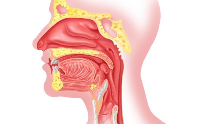 Làm thế nào để chẩn đoán phân biệt ung thư hạch mũi nguyên phát?