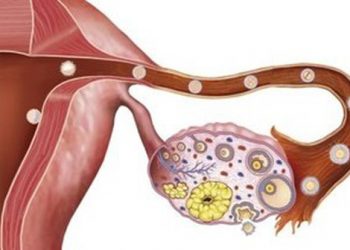 Ung thư biểu mô tuyến sinh dục dạng ống là gì? Những thông tin chung