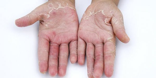Các hạng mục khám cho bệnh bàn tay là gì?